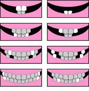 Dentinax Gel in welchem ​​Alter 