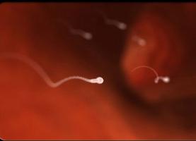Wo kann ich ein Spermatogramm machen? Ergebnisse, Interpretation der Analyse