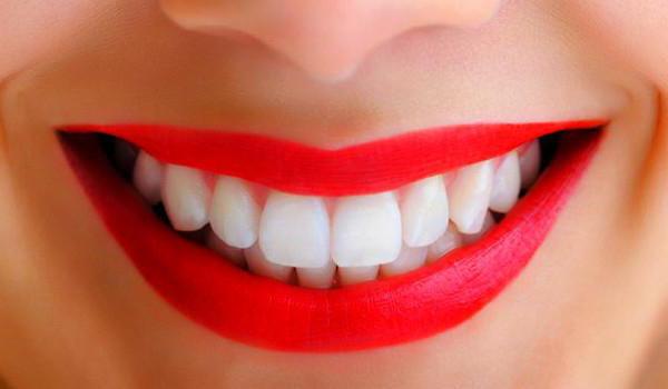 Laminierende Zähne: eine Beschreibung des Verfahrens, Bewertungen