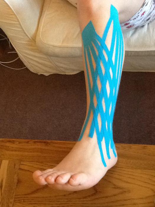 Gips kinesio TEIP was ist es