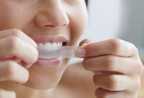 Zähne bleichen zu Hause: praktische Tipps