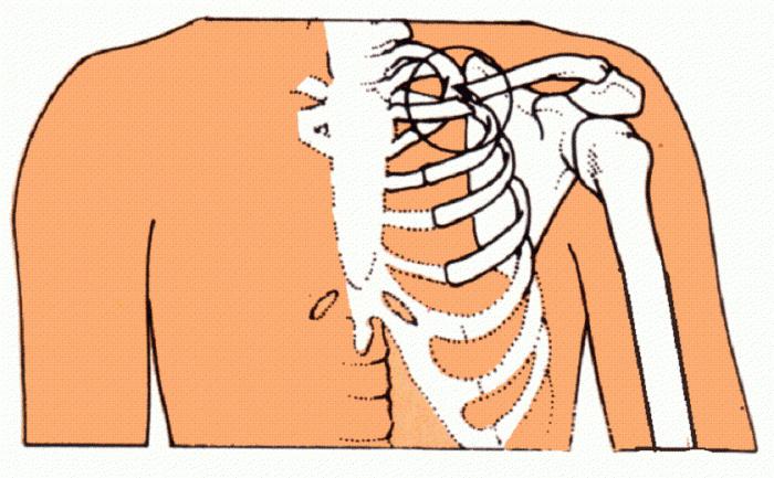 Frakturen der Klavikula: Ursachen, Zeichen, Behandlung