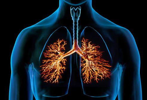 obstruktive Bronchitis